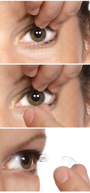 Lens-Removal-photos_a